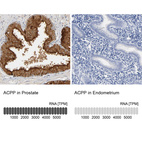 Anti-ACPP Antibody