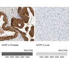 Anti-ACPP Antibody