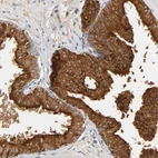 Immunohistochemical staining of human prostate shows strong cytoplasmic positivity in glandular cells.