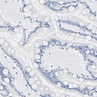 Immunohistochemical staining of human small intestine shows no cytoplasmic positivity in glandular cells as expected.