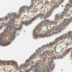 Anti-IFITM3 Antibody