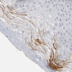 Immunohistochemical staining of human cervix, uterine shows strong cytoplasmic granular positivity in squamous epithelial cells.