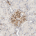 Anti-IFITM3 Antibody