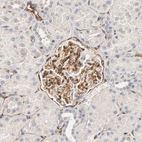 Immunohistochemical staining of human kidney shows strong cytoplasmic granular positivity in cells in glomeruli.