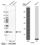 Western blot analysis in human cell lines SK-MEL-30 and Caco-2 using Anti-IFITM3 antibody. Corresponding IFITM3 RNA-seq data are presented for the same cell lines. Loading control: Anti-HDAC1.