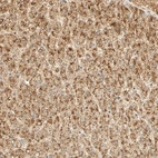 Anti-GNRH2 Antibody