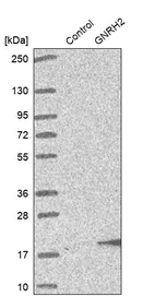 Western blot analysis in control (vector only transfected HEK293T lysate) and GNRH2 over-expression lysate (Co-expressed with a C-terminal myc-DDK tag (~3.1 kDa) in mammalian HEK293T cells, LY405967).