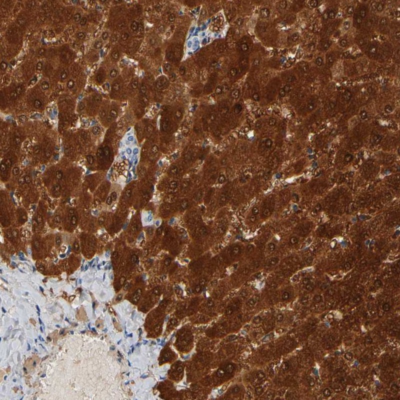 Anti-GSTA1 Antibody
