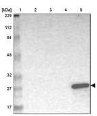 Lane 1: Marker [kDa] 229, 112, 84, 48, 32, 27, 17_br/_Lane 2: Human cell line RT-4_br/_Lane 3: Human cell line U-251MG sp_br/_Lane 4: Human plasma (IgG/HSA depleted)_br/_Lane 5: Human liver tissue