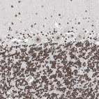 Immunohistochemical staining of human cerebellum shows strong nuclear positivity in cells in granular layer.