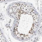 Immunohistochemical staining of human testis shows moderate nuclear positivity in cells in seminiferous ducts.