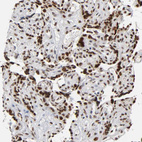 Anti-TRIM33 Antibody