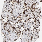 Immunohistochemical staining of human placenta shows strong nuclear positivity in trophoblastic cells.
