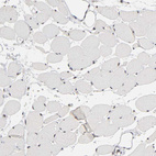 Immunohistochemical staining of human skeletal muscle shows no positivity in myocytes as expected.