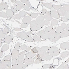 Immunohistochemical staining of human skeletal muscle shows no positivity in myocytes as expected.