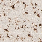 Immunohistochemical staining of human cerebral cortex shows strong granular cytoplasmic positivity in neurons.
