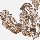 Immunohistochemical staining of human placenta shows strong granular cytoplasmic positivity in trophoblastic cells.