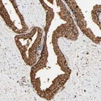 Immunohistochemical staining of human prostate shows strong granular cytoplasmic positivity in glandular cells.
