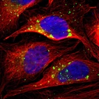 Immunofluorescent staining of human cell line U-2 OS shows localization to vesicles.