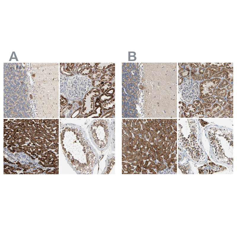 Anti-ACAT1 Antibody