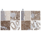 Anti-ACAT1 Antibody