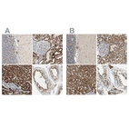Anti-ACAT1 Antibody