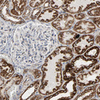 Anti-ACAT1 Antibody