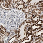 Immunohistochemical staining of human kidney shows strong positivity in mitochondria in cells in tubules.