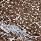 Immunohistochemical staining of human liver shows strong positivity in mitochondria in hepatocytes.