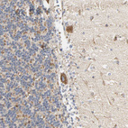 Immunohistochemical staining of human cerebellum shows strong positivity in mitochondria in purkinje cells.