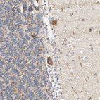 Anti-ACAT1 Antibody