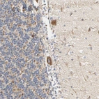 Immunohistochemical staining of human cerebellum shows strong positivity in mitochondria in purkinje cells.