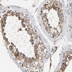 Anti-ACAT1 Antibody