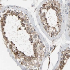 Immunohistochemical staining of human testis shows strong positivity in mitochondria in cells in seminiferous ducts.