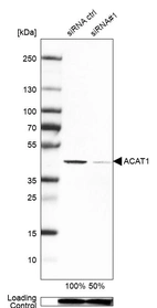 Western blot analysis in Caco-2 cells transfected with control siRNA, target specific siRNA probe #1, using Anti-ACAT1 antibody. Remaining relative intensity is presented. Loading control: Anti-PPIB.