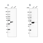 Western blot analysis using Anti-ACAT1 antibody HPA004428 (A) shows similar pattern to independent antibody HPA007569 (B).