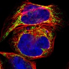Immunofluorescent staining of human cell line A-431 shows localization to mitochondria.