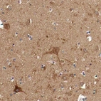 Immunohistochemical staining of human hippocampus shows positivity in subsets of neuronal cells.