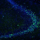 Immunofluorescence staining of mouse hippocampus shows positivity in a subset of neurons.