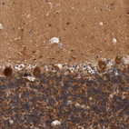 Immunohistochemical staining of human cerebellum shows cytoplasmic immunoreactivity in Purkinje cells, as well as positivity in the molecular and granular cell layers.