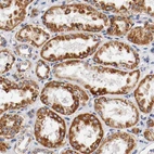 Immunohistochemical staining of human kidney shows strong cytoplasmic positivity in tubular cells.