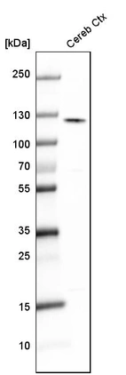 Western blot analysis in human cerebral cortex tissue.
