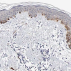 Immunohistochemical staining of human skin shows moderate membranous and cytoplasmic positivity in squamous epithelial cells.