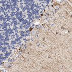 Immunohistochemical staining of human cerebellum shows moderate membranous and cytoplasmic positivity in Purkinje cells.
