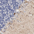 Immunohistochemical staining of human cerebellum shows moderate membranous and cytoplasmic positivity in Purkinje cells.
