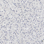 Immunohistochemical staining of human liver shows no positivity in hepatocytes as expected.