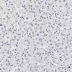 Immunohistochemical staining of human liver shows no positivity in hepatocytes as expected.