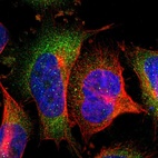 Immunofluorescent staining of human cell line U-251 MG shows localization to cytosol.