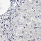 Immunohistochemical staining of human liver using Anti-AFG3L2 antibody HPA004479.