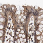 Immunohistochemical staining of human colon using Anti-AFG3L2 antibody HPA004479.